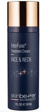 Load image into Gallery viewer, InterFuse Treatment Cream / FACE & NECK