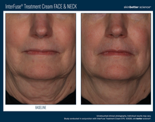 Load image into Gallery viewer, InterFuse Treatment Cream / FACE & NECK