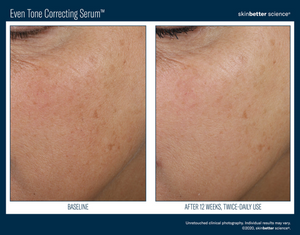 Even Tone Correcting Serum